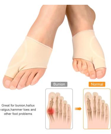 Gel Bunion Sleeve for Men & Women | Bunion Corrector & Relief with Gel Pad for Big Toe Straightener | Day & Night Use for Hallux Valgus, Hammer Toe, Tailors Bunion - Buy Online on GoSupps.com