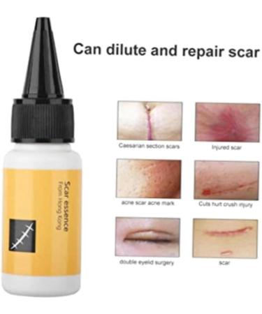 Scar Removal Cream - Acne Scar Treatment Serum for Smooth & Delicate Skin 20mL - Buy Online on GoSupps.com