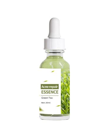 Acne Repair Face Serum Firming Serum For Face Green Tea Hyaluronic Acid Serum Relieve Redness & Acne Natural Face Serum For Acne Day & Night Serum For Face Hydrating Face Oils And Serums-Repair