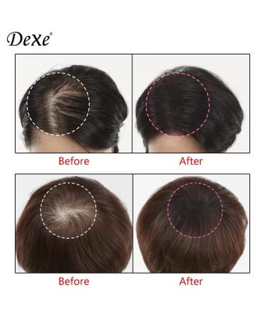 Dexe Root Cover Up - Black 6g | Instant Root Touch Up for Any Hair Type - Fast International Shipping - Buy Online on GoSupps.com