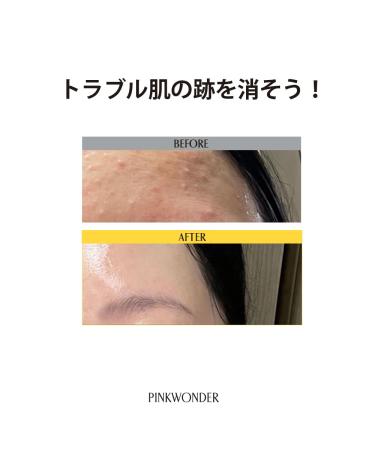 Buy Tamanu Hero Clay-Fit Mask (3EA) - Best Clay Sheet Mask for Oily Skin Pore & Blackhead Treatment | Korean Skincare - Buy Online on GoSupps.com