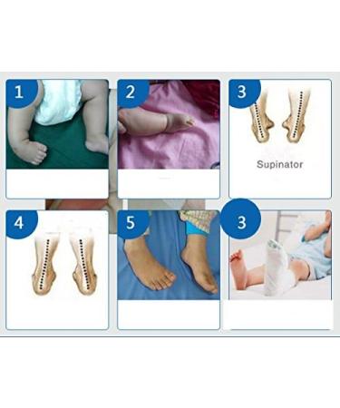Kids AFO Drop Foot Splint - Toddler Ankle Foot Brace Night Splint (16cm) - Buy Online on GoSupps.com