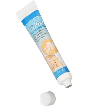 Vitiligo Cream 30G - Herbal Extract Treatment for White Spots & Skin Pigmentation - Creme Medix Leukoplakia Solution - 0.7oz - Buy Online on GoSupps.com