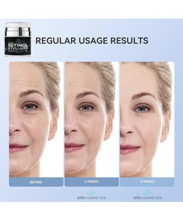 Retinol Cream for Face & Neck - Collagen Moisturizer Anti-Aging Day & Night Cream with Hyaluronic Acid - Made in USA - Buy Online on GoSupps.com