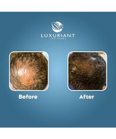 Luxuriant Asian Herbs Hair Growth Shampoo & 2 Serums | Promotes Healthy Hair Growth | Anti-Dandruff Moisturizing & Thickening Solutions | For All Hair Types (1 x 250ml) - Buy Online on GoSupps.com