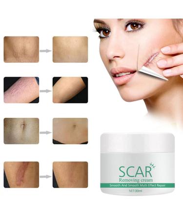 Hotiary Plant Scar Repair Cream - Acne & Stretch Mark Remover for Scars, Burns, Postoperative Skin - Men & Women - Buy Online on GoSupps.com