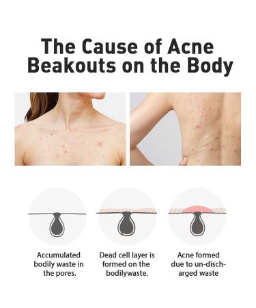 Dashu Daily Acne Relax Body Wash 16.9fl oz - Cooling Acne Treatment - Buy Online on GoSupps.com