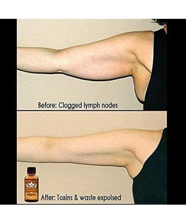 Ginger Essential Oil for Lymphatic Drainage | Natural Body Massage Oil for Swelling - Buy Online Internationally - Buy Online on GoSupps.com