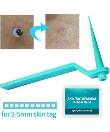 77PCS Skin Tag Remover Patches for 2-5mm Skin Tags - Green Skin Tag Removal Kit - Buy Online on GoSupps.com