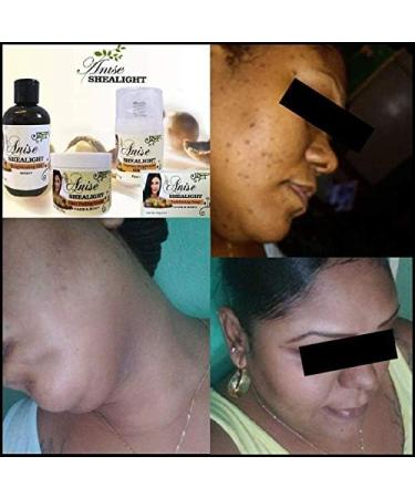  Anise Anise Shealight Supreme Brightening Serum 50ml 100% Organic Product - Buy Online on GoSupps.com