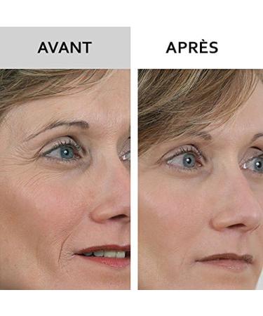 SKINEANCE - WRINKLE FILLER WRINKLE FILLER - Smoothes fills and smoothes fine lines and wrinkles - Precise instant and long-lasting results - Proven effectiveness - set of 3 tubes of 15 ml - Buy Online on GoSupps.com