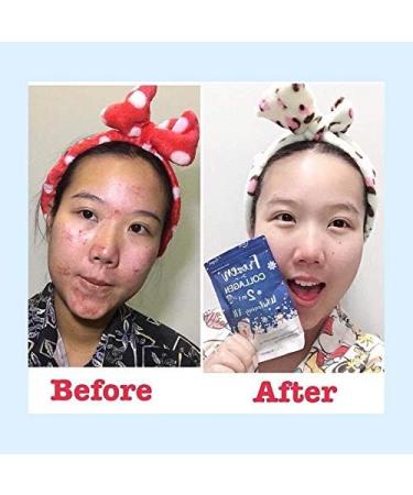 Gluta Frozen Collagen 2 In 1 Whitening Capsules - Nourishes Skin, Reduces Freckles, Dark Spots & Acne, Promotes Healthy Hair & Nails - 60 Capsules - Buy Online on GoSupps.com