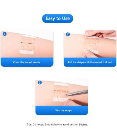 Emergency Wound Closure Strips - Butterfly Bandages for First Aid | Adhesive Sutures for Zipper Laceration Repair (S) - 1 Piece 2.76x1.97 - Buy Online on GoSupps.com