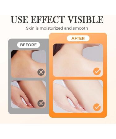 Gel Exfoliant Orange pour le Visage et Le Corps Nettoyage en Profondeur des Pores limination des Points Noirs Soin Hydratant pour la Peau Gommage Naturel L'orange (2 PCS Orange) 2 PCS 1 unit (Lot de 1) - Buy Online on GoSupps.com