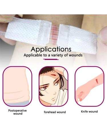Emergency Wound Closure Kit - Zip Stitch Band-Aid Laceration Repair Stickers - Buy Online on GoSupps.com