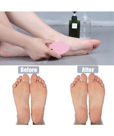 Pumice Stone 2 Pcs for Women | Multi-Colored Callus Remover by MAYKI | Foot Scrubber Stone for Smooth Skin - Buy Online on GoSupps.com