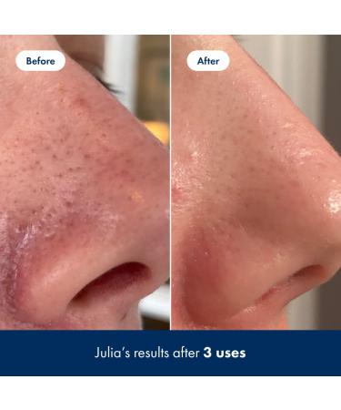 Hero Cosmetics Pore Release Blackhead Clearing Solution - Exfoliating Toner with BHA, PHA, AHA & 2% Salicylic Acid - 100ml - Buy Online on GoSupps.com