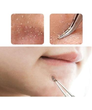 1Pc Professional Stainless Bend Curved Tweezer Blackhead Acne Clip Comedone Pimple Extractor Remover Tool for Comedone Whitehead Acne Blemish Bend Clip Nice and clever - Buy Online on GoSupps.com