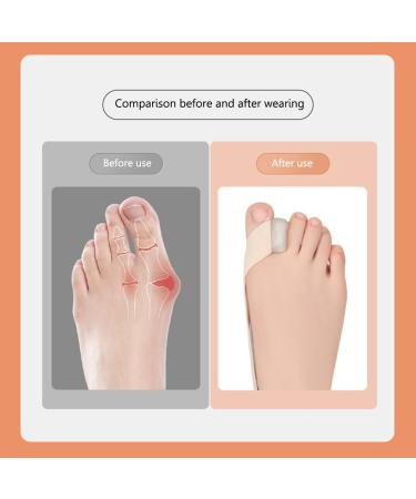 Fiorky Unisex Hallux Valgus Device | Pain Relief for Bunions & Large Toes | Adjustable Toe Separator - Perfect for Daily Wear - Buy Online on GoSupps.com