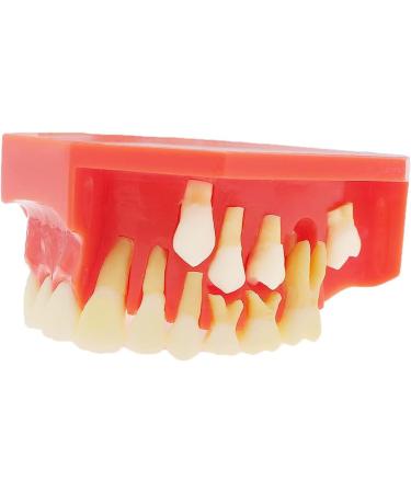 Lmeil Silicone Tooth Development Model for Children | Milk Teeth & Deformality Education Tool - Buy Online on GoSupps.com