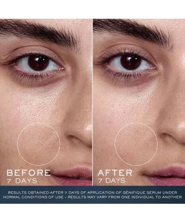 Lanc me Advanced G nifique Limited Edition Skincare Set - Full Size Serum Night Cream & Cleanser - International Shipping Available - Buy Online on GoSupps.com