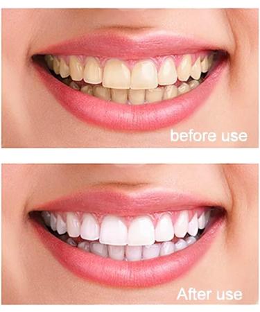 100% Pure Nano Hydroxyapatite Tooth Powder Enamel Remineralization Support, Fluoride-Free Toothpaste Additive for Sensitivity & Cavity Defense, Pure HAp Powder 30g 1.06 Ounce (Pack of 1) - Buy Online on GoSupps.com