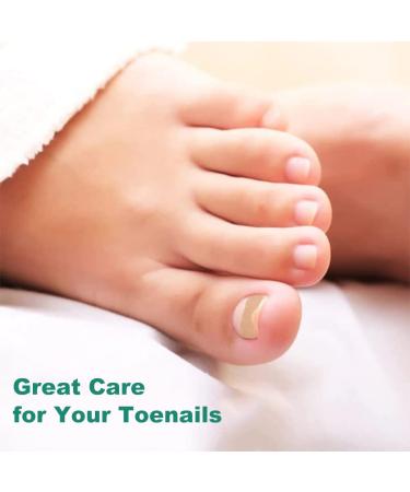 Ingrown Toenail Corrector Patch - 50PCS Natural Strips for Painless Treatment and Relief from Nail Groove - Glue-free Solution - Buy Online on GoSupps.com