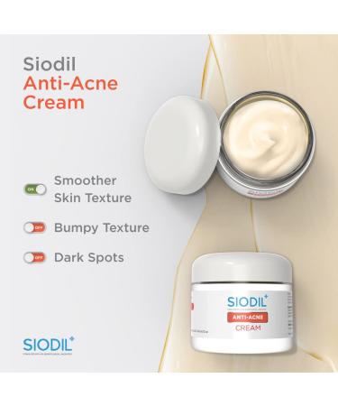 Anti Acne Cream | Face Moisturizer for Oily & Acne Prone Skin | Vitamin C & Niacinamide | 60 ml - Healthy Youthful Skin - Buy Online on GoSupps.com