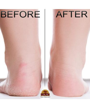 OKAY Peppermint Foot Scrub 6oz - Refreshing Peppermint Exfoliating Scrub - Buy Online on GoSupps.com