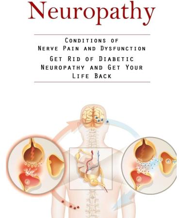 Dr. WellMe Lipinerve R Alpha Lipoic Acid 300mg Capsules - Antioxidant Supplement Kosher | Halal 30 Count Made in USA - International Shipping Available - Buy Online on GoSupps.com