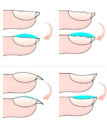 Self-Leveling Gel Polish 15ml Semipermanent Nail Polish Reinforcement Gellac Manicure Rubber Base uv led Varnish No-Wipe Top Lak - (Color: Self-Leveling Gel) - Buy Online on GoSupps.com