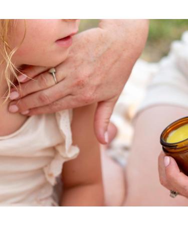 Motherlove Children's Chest Rub (2 oz) Herbal Balm for Soothing Congestion for Ages 2 and up Organic & Cruelty Free - Buy Online on GoSupps.com
