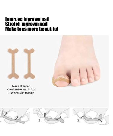 Professional Toenail Correction Tool Set - Steel Nail Corrector Voter & File for Perfect Toenails - Buy Online on GoSupps.com