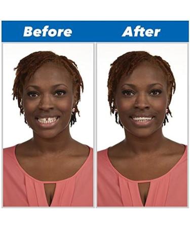 Instant Perfect Smile Kit | SHOP-STORY Replacement Tooth - Reusable & Removable | International Shipping Available - Buy Online on GoSupps.com