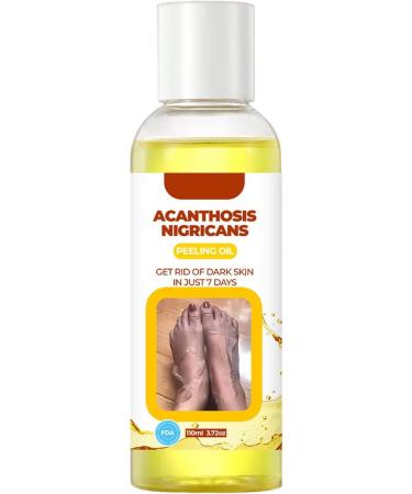  JPSDOWS Extra Yellow Peeling Oil Extra Strong Natural Spots Whiten for Dark Skin Whiten Yellow Peeling Oil for Exfoliates Improves Dullness Hyperpigmentation Evens Out - Buy Online on GoSupps.com