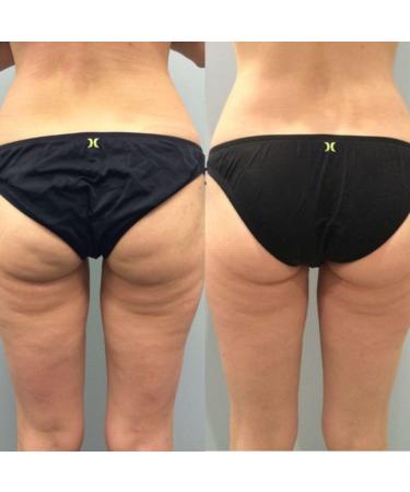 Bum bum Cream Firming & Lifting Body Cream for Cellulite and Stretch Marks With Natural Brazilian Extracts 8oz Smooth Hydrate & Tighten Skin All Skin Types - Buy Online on GoSupps.com