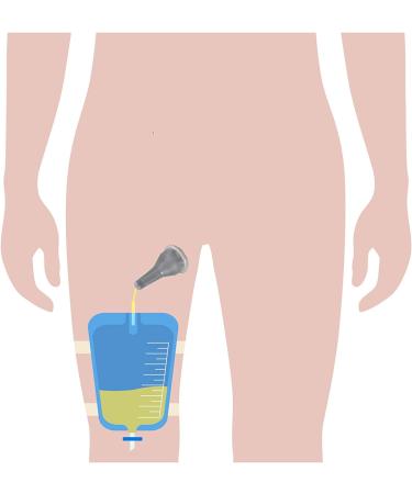 25-Units Silicone Urinal Bag Male External Catheter Single use with Adhesive Strip (Large 30 mm 1.2 Inches) - Buy Online on GoSupps.com