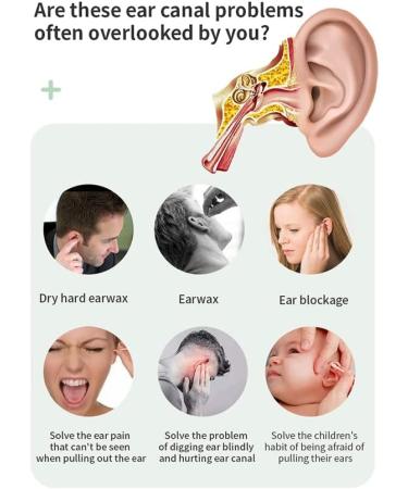 Smala Electric Earwax Removal Kit - USB Rechargeable Ear Irrigation Device - Buy Online on GoSupps.com