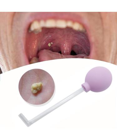 Tonsil Stone Remover Vacuum Tonsil Stone Removal Kit Tool Tonsil Stone Treatment Oral Suction Tool Dental Suction Mouth Cleaner Mouth Cleaning Oral Care Mouth Cleaner for Adults (Purple)