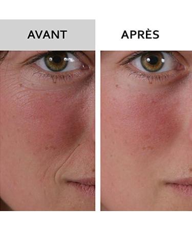 SKINEANCE - WRINKLE FILLER WRINKLE FILLER - Smoothes fills and smoothes fine lines and wrinkles - Precise instant and long-lasting results - Proven effectiveness - set of 3 tubes of 15 ml - Buy Online on GoSupps.com