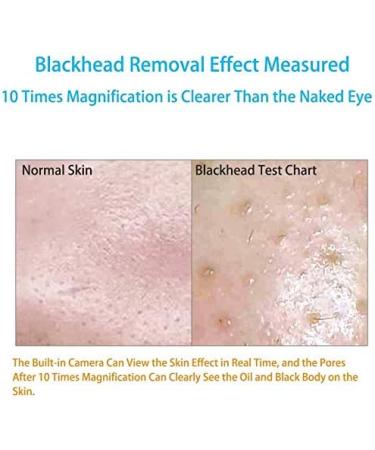 FEDRUI HD Visual Electric Blackhead Absorber USB Rechargeable Blackheads Suction Device 6 Gears Blackhead Remover with Microscope for Facial Deep Cleansing - Buy Online on GoSupps.com