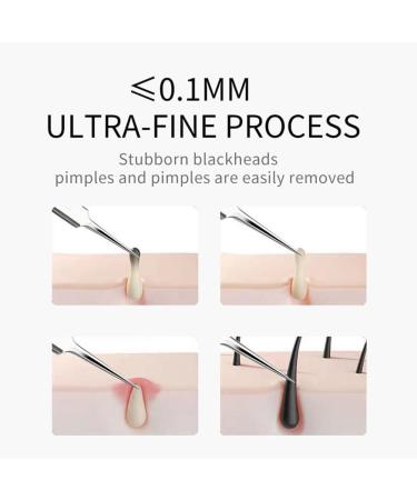 Professional Ultra-fine No. 5 Acne Blackhead Removal Tweezers Beauty Salon Pimples Care Clip Face Needles Deep Cleaner Tool Skin Diaphragm Clip - Buy Online on GoSupps.com