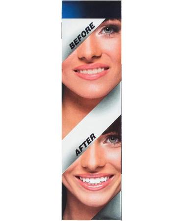 White Glo Accelerator Professional Teeth Whitening Kit with LED Light for Sensitive Teeth and Gums - Blue Light Activated Gel for Best Teeth Whitening Results - 10 Min Timer & 50 Uses! - Buy Online on GoSupps.com