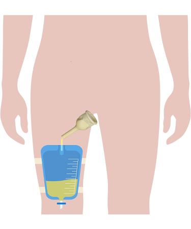 Urinary 5-Day Kit: 5 Self-Seal Condom Catheters + 1 Leg Bag + Straps (Small 20mm) - 750ml - Buy Online on GoSupps.com