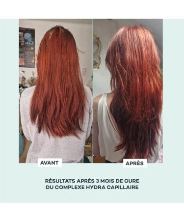 D-LAB |Complexe Hydra Capillaire | Cure 3 mois | Vitamines Huiles et Actifs V g taux | R pare Cheveux Secs et Ab m s Stimule la Pousse et Redonne Brillance | Fabriqu en France - Buy Online on GoSupps.com