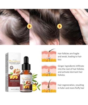 SADOER Ginger Hair Growth Oil - Plant-Powered Serum for Stronger Thicker Hair | Anti-Hair Loss Solution for Women & Men (3 Pack - Buy Online on GoSupps.com