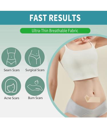 Sialicess Reusable Silicone Scar Strips for Keloid & Hypertrophic Scars - 2 Month Supply - 4 PCS - Buy Online on GoSupps.com