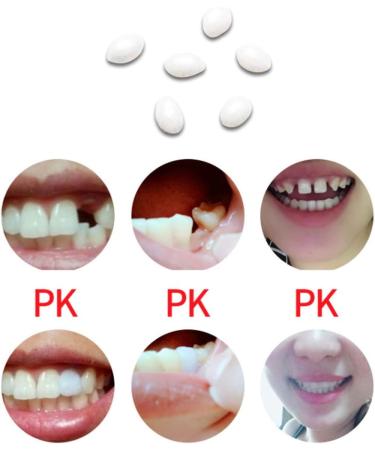 Aunye Temporary Tooth Repair Kit | Fix Broken Teeth & Dentures | Perfect for Halloween & Cosplay (20ml) - Buy Online on GoSupps.com