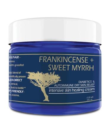 Frankincense + Sweet Myrrh Cream  INTENSIVE FOOT THERAPY | Diabetic Skin Healing Cream  Synergistic Action Deeply Nourishing + Relieving  Balm of Gilead