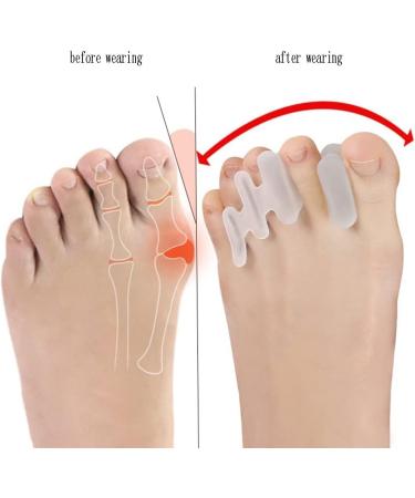 DEAVER Hallux Valgus Corrector Insoles - Toe Separator Gel Spreader for Foot Bone Overlapping Correction - 4 Pair Set for Men and Women - Instant Pain Relief - Buy Online on GoSupps.com